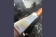 Dos policías resultaron con quemaduras luego de ser agredidos con agua caliente