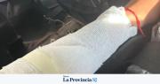 Policías sufrieron quemaduras tras ser agredidos con agua caliente