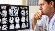 El alimento que ayuda a prevenir el Alzheimer y podés incluirlo en muchas comidas