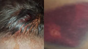 Denuncian violencia policial contra cuatro jóvenes