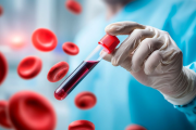 10 señales de la anemia y cómo prevenir esta condición