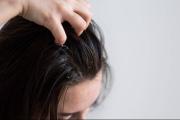 ¡Adiós caspa! Esta es la mascarilla natural que elimina cualquier impureza del cabello: solo necesitas tres ingredientes