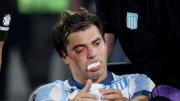 Preocupación en Racing: Santiago Sosa sufrió una fractura en la cara