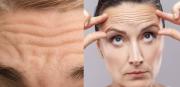 Emociones y estrés aceleran la formación de arrugas, según estudios científicos