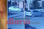 Video: automovilista chocó a joven santiagueño y se dio a la fuga