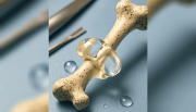 Científicos prueban con éxito un adhesivo que une huesos en minutos