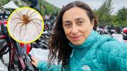 Deportista chilena terminó en la UCI tras picadura de una araña de rincón: Estuve a punto de perder el brazo