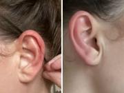 Qué significa cuando te arde la oreja izquierda, según la cultura popular