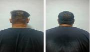 Dos hombres fueron detenidos por agredir a su vecina con una silla en Puerto Cabello