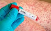 La sífilis creció un 20% de un año a otro en el país