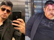 Quién es Calabaza, el acusado de matar a un financista que se fugó en taxi de una comisaría y cayó en un auto robado