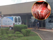 Una nena de 11 años fue hospitalizada en Corrientes por una grave infestación de larvas en la cabeza