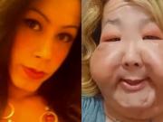 Una operación clandestina la dejó con deformidades: ahora comenzó una dura reconstrucción facial