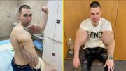 El Popeye ruso: Influencer se inyectó vaselina en los bíceps y ahora podría perder ambos brazos
