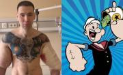 Un influencer ruso se inyectó vaselina para ser como Popeye y ahora podría perder los dos brazos