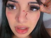 La tiktoker que fue golpeada a la salida de un boliche mostró como le quedó la cara