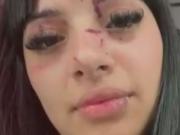 Una joven fue agredida brutalmente por patota a la salida de un boliche