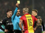 Indignación en la Europa Legue: jugador se burló de rival que nació con labio leporino