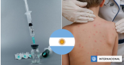 Alerta en Argentina: vacunación se desploma a menos del 50% de la población y hay brotes de sarampión