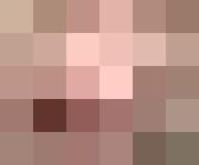 UN VEHÍCULO EXPLOTA EN SANTA CRUZ MIENTRAS CARGABA COMBUSTIBLE; HAY DOS PERSONAS HERIDAS