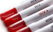 Casi la mitad de las personas con VIH se entera tarde