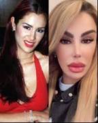 Ninel Conde necesita un reajuste: conoce sus próximo procedimientos estéticos