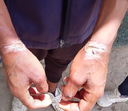 Tarija: Recluso es sorprendido fumando marihuana, desafía a dos policías y denuncia que lo colgaron con manillas