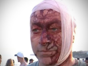 Sobrevivió al ataque de Hamas y hoy fue herido en Australia