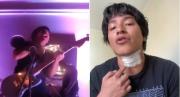 VIRAL: Cantante se electrocutó con su propio micrófono en pleno concierto y todo quedó grabado
