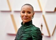 Tu cabello habla: 10 señales de alerta para tomar en cuenta sobre la caída excesiva