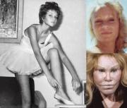 El precio de la perfección: tres celebridades que desfiguraron su rostro con cirugías estéticas