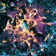 Científicos implantan un embrión en un endometrio artificial