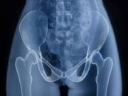 Descubren por qué se destruye el cartílago en la artrosis y cómo regenerarlo