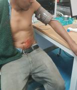 Recibió una cuchillada de su primo