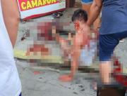 Ataque armado en el ingreso al sitio Colón, en Portoviejo, dejó a un hombre en estado crítico