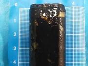 Sintió dolores abdominales y descubrió que llevaba más de 30 años con un encendedor alojado dentro de su cuerpo