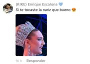 Miss Universe Venezuela, Clara Vegas, se ríe mientras los fans intentan descifrar qué se hizo en el rostro
