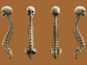 ¿Es posible una terapia eficaz y segura contra la osteoporosis?