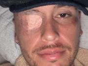 El delicado momento de salud de Lucas Ocampos: tras fracturarse, sufrió una parálisis facial y se pierde la pretemporada en México