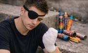 Perdió dedos por jugar con cohetes, le dan de alta, prende otro pirotécnico y pierde el ojo