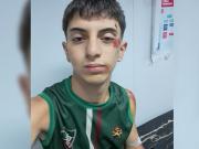 Tiene 18 años, es bombero voluntario y salió de su casa al sonar la sirena, pero le robaron la bici y le dieron una paliza