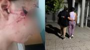 Horror en Santa Fe: atacaron a cuchillazos a una adolescente de 15 años y le desfiguraron la cara