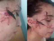 Atacaron a cuchillazos a una joven hasta desfigurarla: tres adolescentes detenidos y un historial de bullying