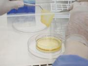 Sufrió quemaduras en el 60% del cuerpo y logran que recupere su propia piel con una nueva técnica en el país