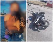Joven de 21 años iba a trabajar en moto, cayó y un camión le arrolló una de sus piernas