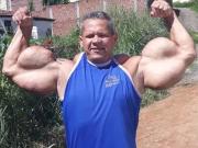 A los 55, murió el “Popeye brasileño”, el hombre que se inyectó aceite en los brazos durante tres décadas para tener bíceps extremos