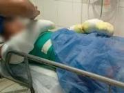 Córdoba: un adolescente está con el 60% del cuerpo quemado después de que le explotó su celular