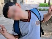 Operan por quinta vez a Bastian, el nene de ocho años fue víctima de un choque en Pinamar