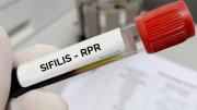 Alerta sanitaria en Argentina: los casos de sífilis crecieron un 71% y marcan un récord histórico