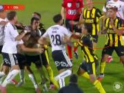 Se dio una situación con un chiquilín: Matías Arezo explicó el origen de la pelea con jugador de Colo Colo